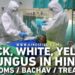 Yellow Fungus in Hindi, Yellow Fugus Symptoms in Hindi, Yellow Fungus Ke Lakshan, Yellow Fungus Kya Hai, Yellow Fungus Treatment in Hindi, Yellow Fungus Se Kaise Bache, Black Fungus in Hindi, Black Fugus Symptoms in Hindi, Black Fungus Ke Lakshan, Black Fungus Kya Hai, Black Fungus Treatment in Hindi, Black Fungus Se Kaise Bache, White Fungus in Hindi, White Fugus Symptoms in Hindi, White Fungus Ke Lakshan, White Fungus Kya Hai, White Fungus Treatment in Hindi, Black Yellow White Fungus, White Fungus Se Kaise Bache