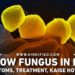 Yellow Fungus in Hindi, Yellow Fungus Kya Hai, What is Yellow Fungus in Hindi, Yellow Fungus Ke Lakshan, Yellow Fungus Symptoms in Hindi, Yellow Fungus Ka Ilaaj, Yellow Fungus Treatment, Yellow Fungus Kaise Hota Hai, Yellow Fungus Kya Hai in Hindi